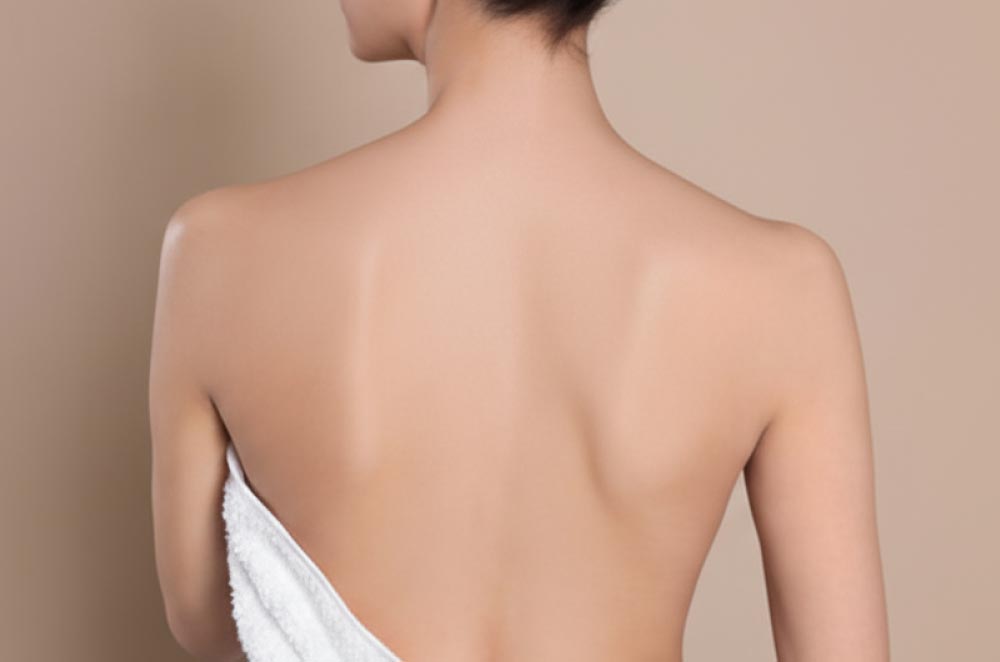 背中ニキビの原因、実はシャンプーが合っていなかった？！